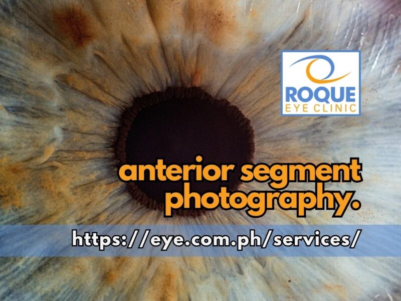 Anterior Segment Photography