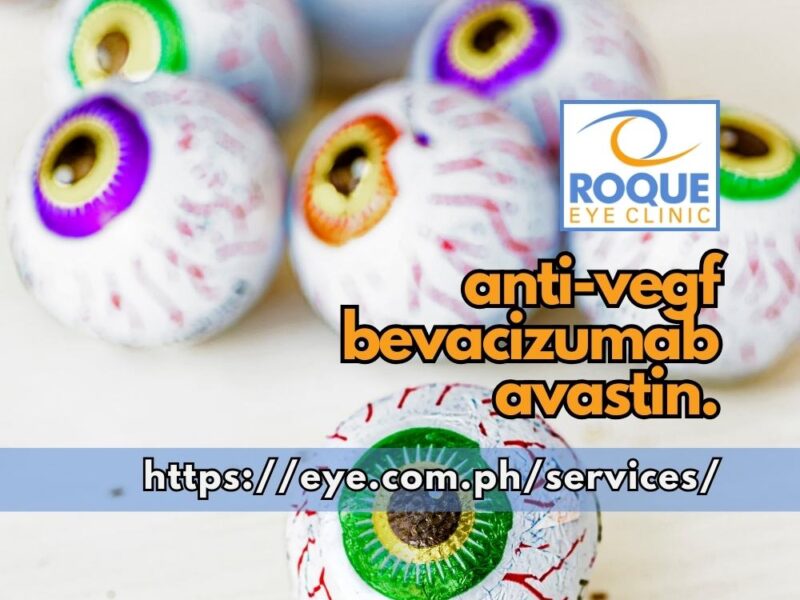 This image shows numerous foil-wrapped chocolate eyeballs, representing different eyes which may benefit from Bevacizumab (Avastin) intravitreal injections.