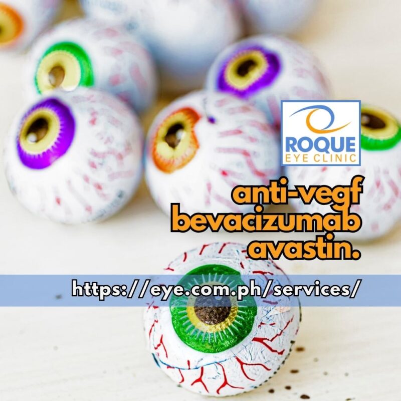 This image shows numerous foil-wrapped chocolate eyeballs, representing different eyes which may benefit from Bevacizumab (Avastin) intravitreal injections.