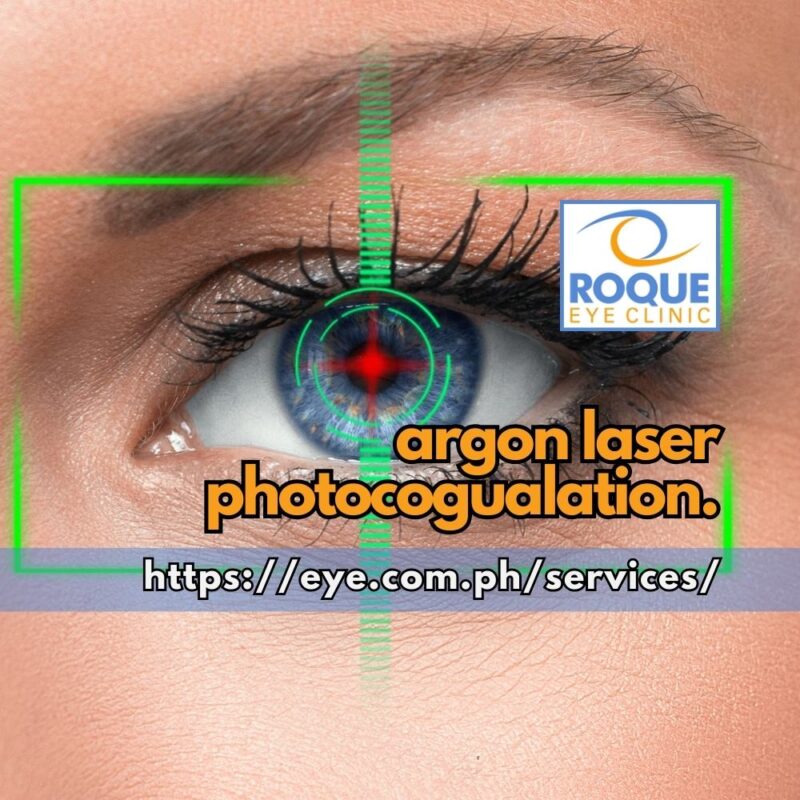 This image shows a computer overlay on the eye showing the precision used during argon laser photocoagulation.