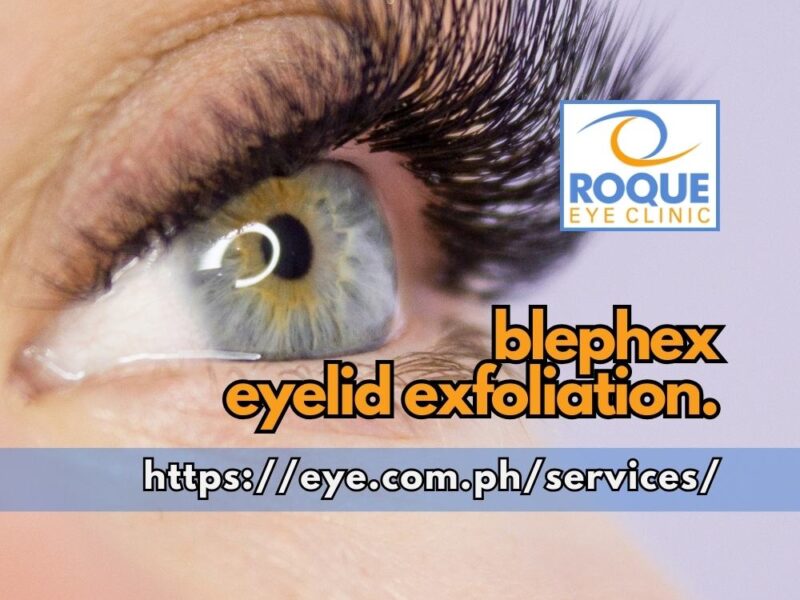 Blephex Eyelid Exfoliation
