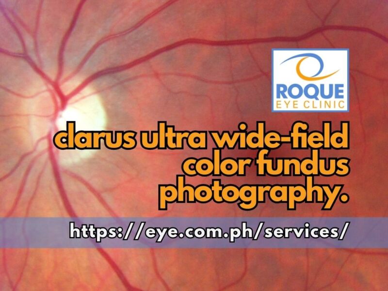 This image shows a normal retina image taken with a clarus ultra wide-field color fundus camera.