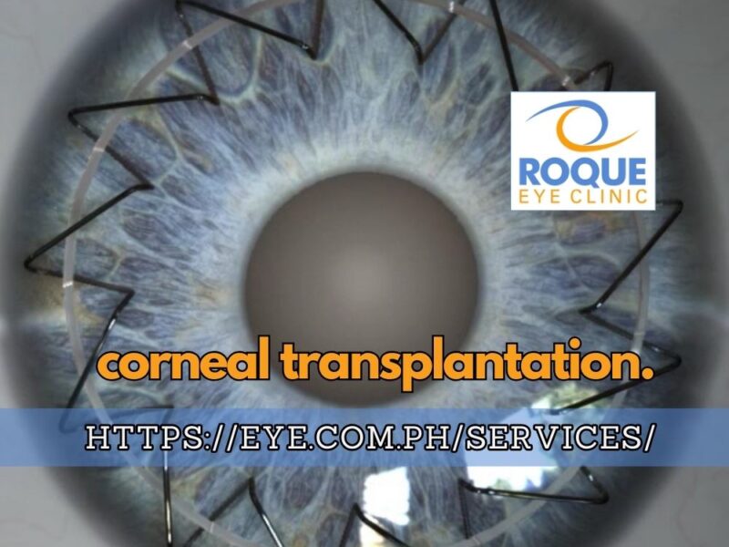 This image shows a cornea, showing the ocular structure treated with corneal transplantation.