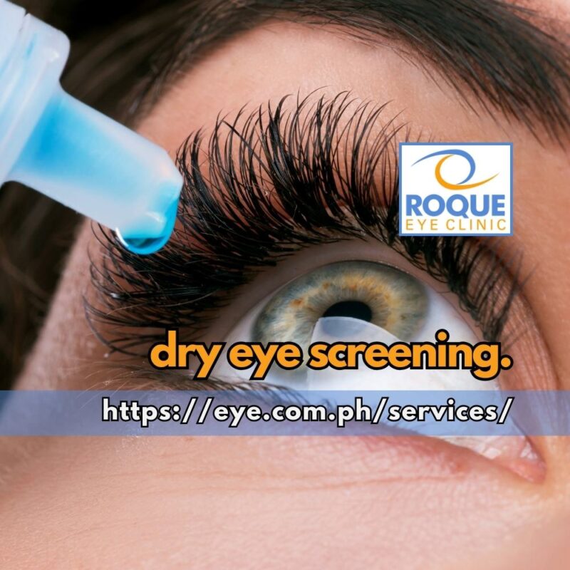 This image shows an ophthalmic lubricant being applied on an eye signifying the utility of dry eye screening for dry eye management.