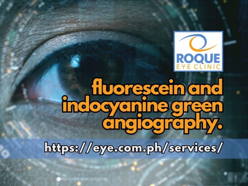 This image shows an eye with a mid-dilated pupil with a graphical overlay of rings and dots signifying a technical procedure with combined fluorescein and indocyanine green angiography.