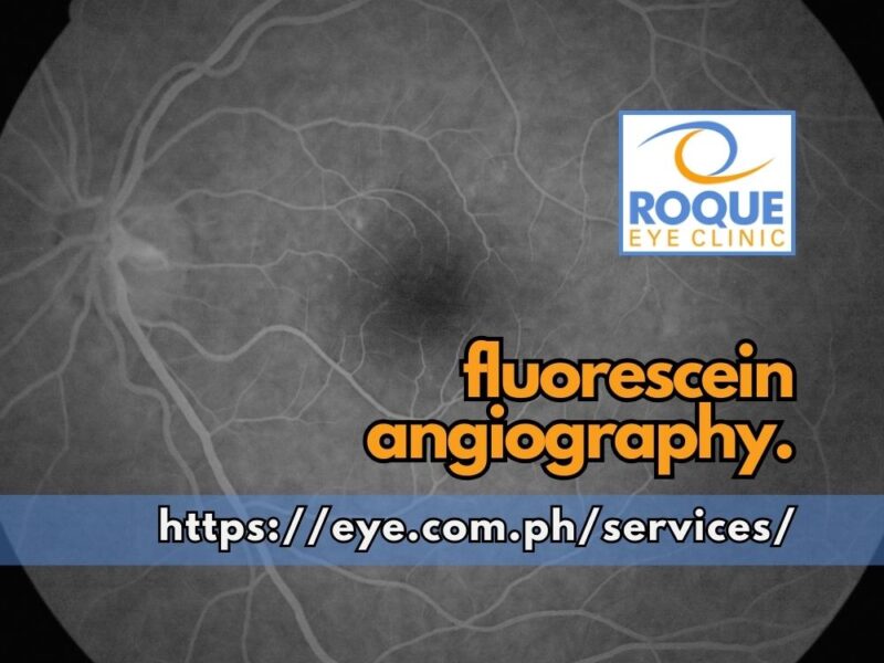 This image shows a late-stage image taken with fluorescein angiography.