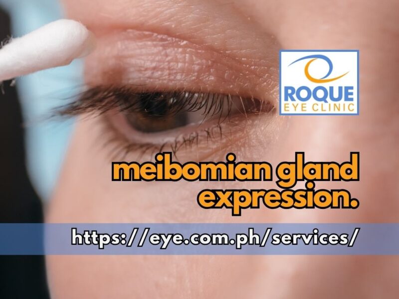 Meibomian Gland Expression