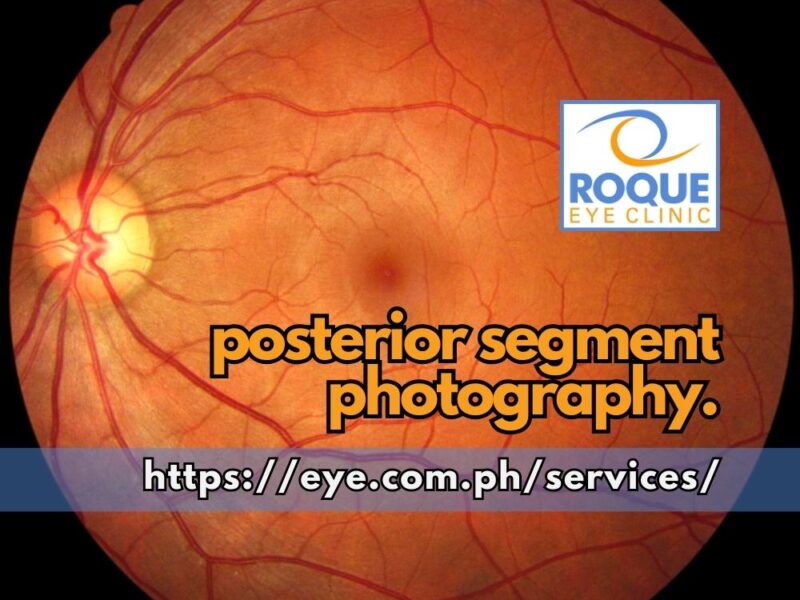 Posterior Segment Photography