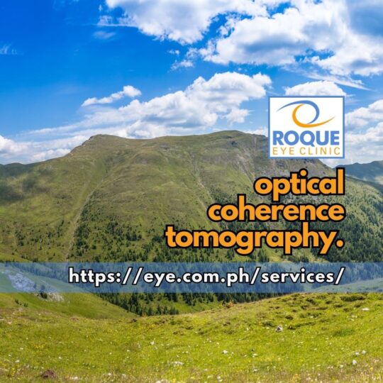 This image shows hills and valleys representing the counters of the macula seen with optical coherence tomography.