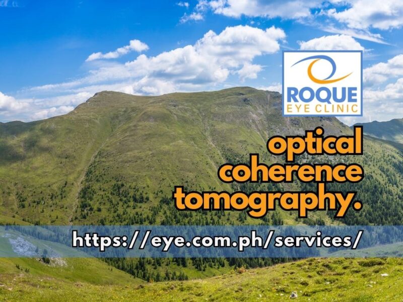 This image shows hills and valleys representing the counters of the macula seen with optical coherence tomography.