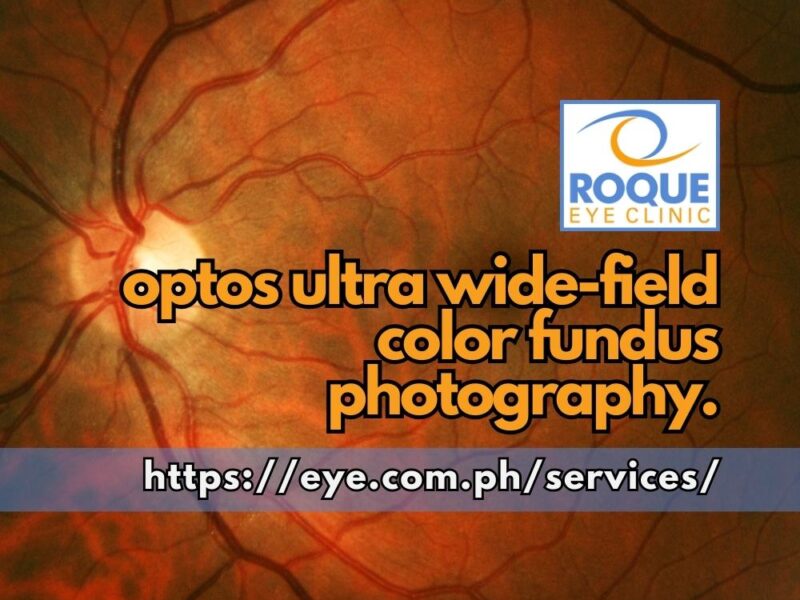 This image shows an OPTOS ultra wide-field color fundus photo of the retina.