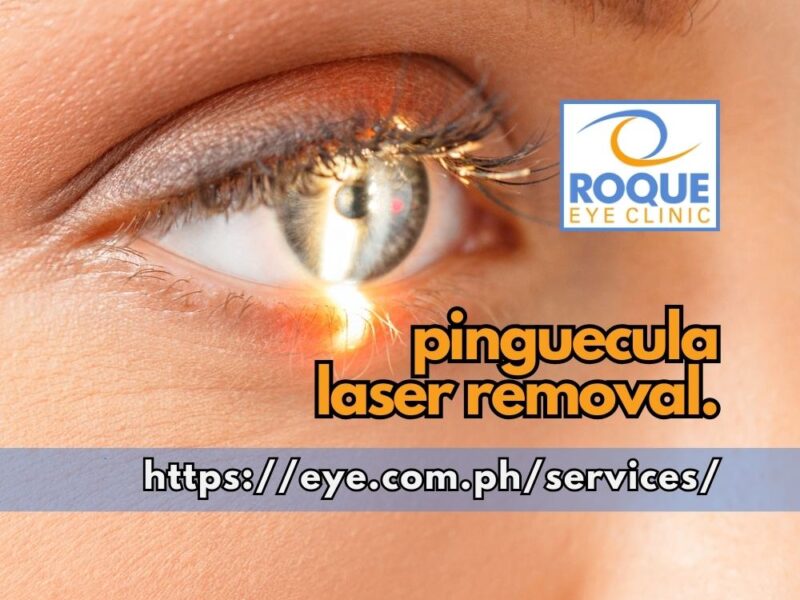 This is an image of the eye being examined under a slit lamp biomicroscope before pinguecula laser removal.