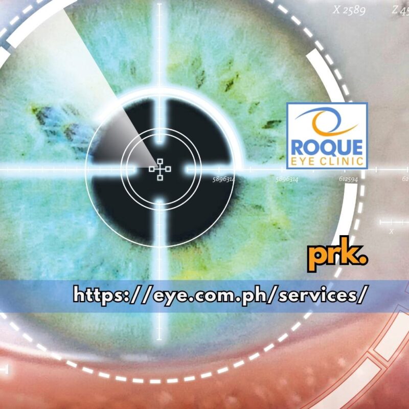This is an image of an eye with a computer overlay signifying the targeting overlay used in PRK laser vision correction.