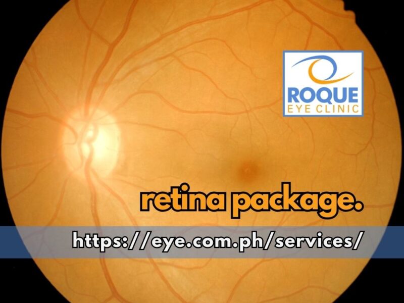 This is an image of a healthy retina taken as part of a retina package.