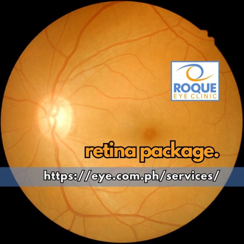 This is an image of a healthy retina taken as part of a retina package.