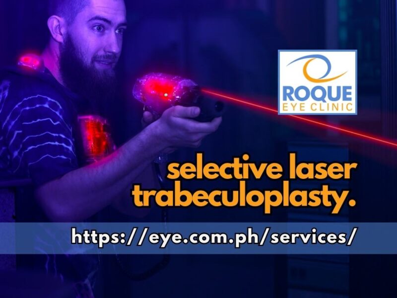 Selective Laser Trabeculoplasty