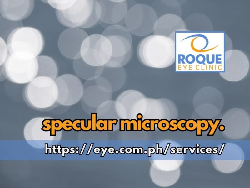 This is an image of refractive specks symbolizing images taken with specular microscopy of the endothelial cells of a cornea.