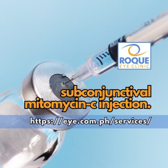 This is an image of a tuberculin syringe aspirating a compounded solution for subconjunctival Mitomycin injection.