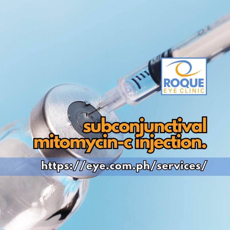 This is an image of a tuberculin syringe aspirating a compounded solution for subconjunctival Mitomycin injection.