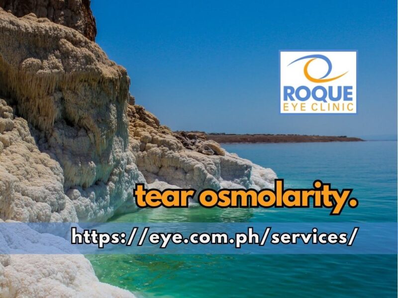 TEAR OSMOLARITY