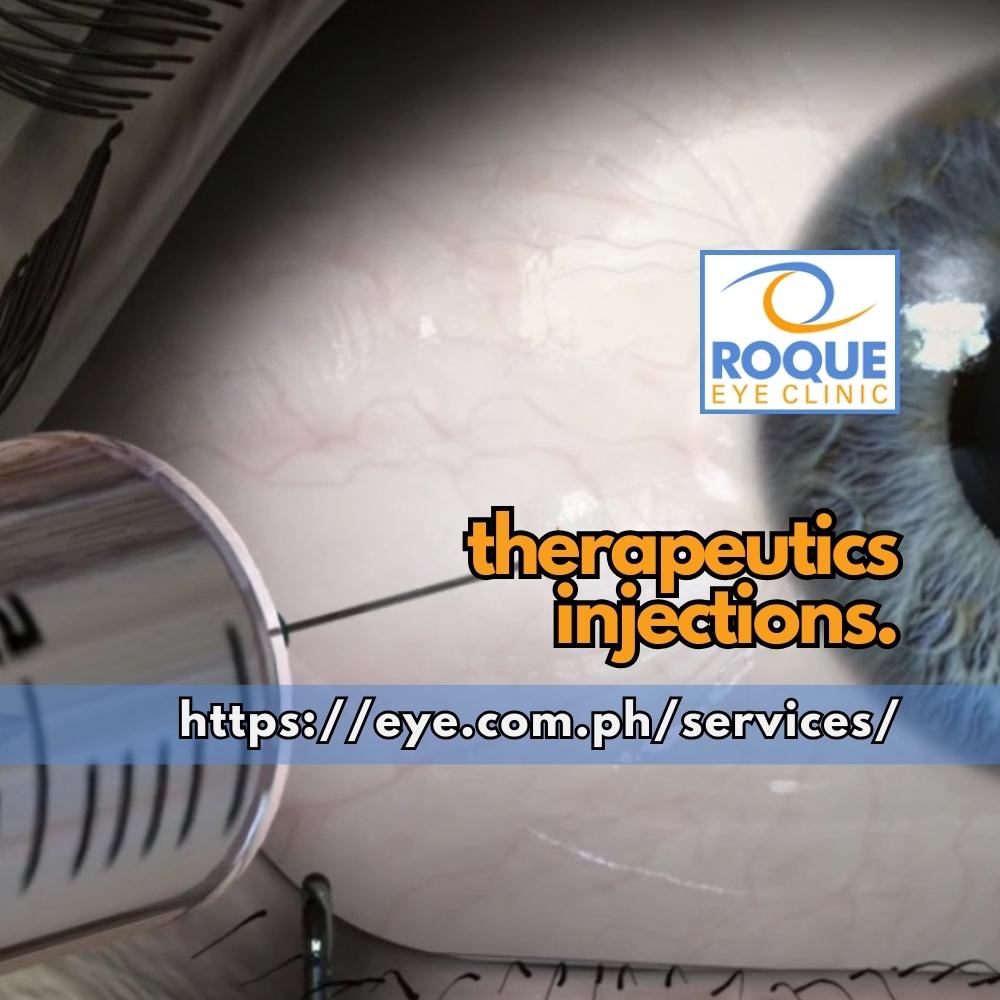 This image shows an illustration of a 30g tuberculin syringe containing 0.05 mL of anti-VEGF medication for therapeutic Intravitreal injection 3.25 mm from the limbus.