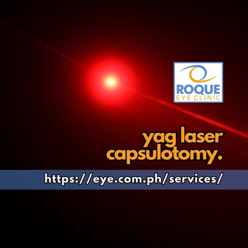 This is an image of a laser focused on a pinpoint target representing the precision required with YAG laser capsulotomy.
