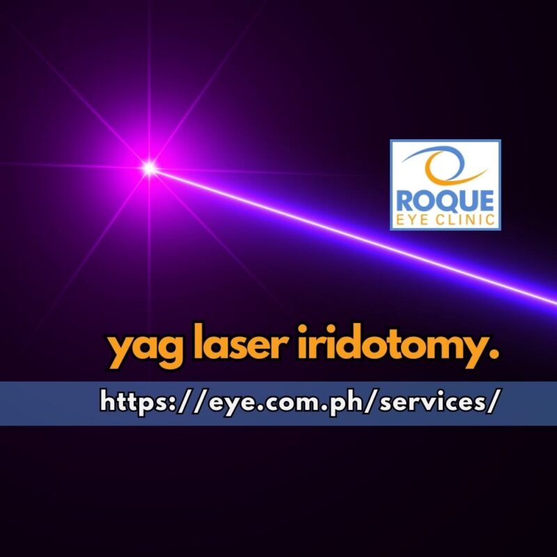 This is an image of a laser beam hitting its target representing disruption resulting from YAG laser iridotomy.