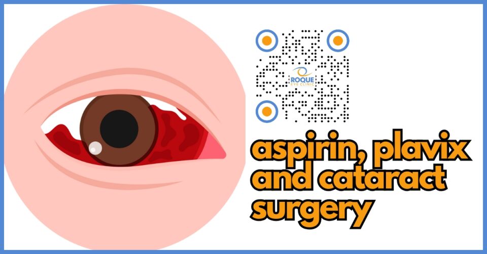 Clopidogrel and Aspirin in Cataract Surgery
