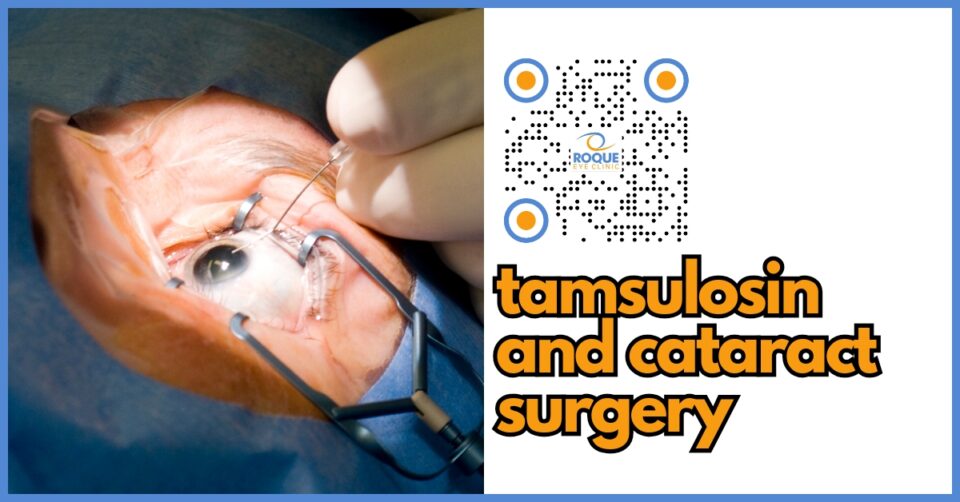 Patient undergoing cataract surgery with precautions for tamsulosin.