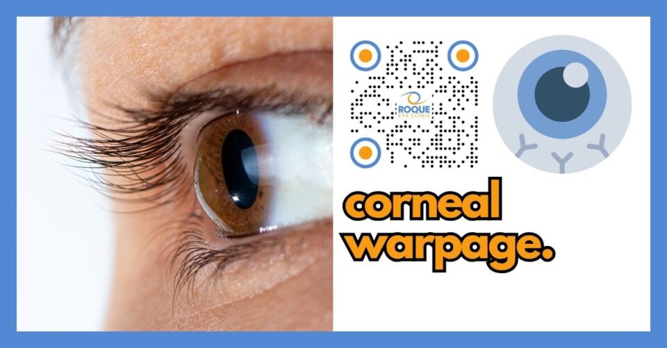 EXTERNAL DISEASES AND CORNEA - CORNEAL WARPAGE