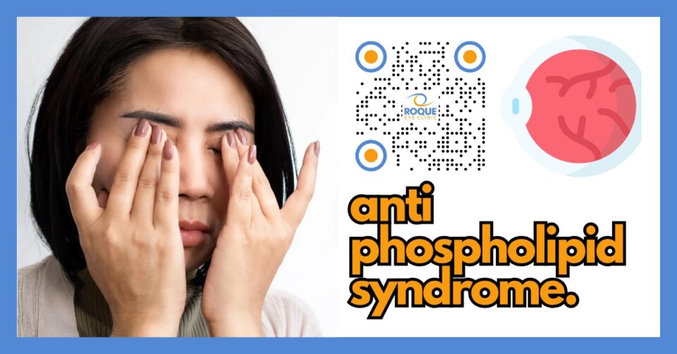 RETINA AND VITREOUS BLOG - ANTI-PHOSPHOLIPID SYNDROME