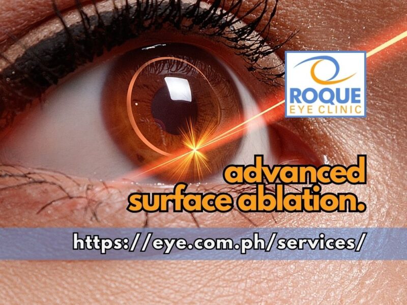 Advanced Surface Ablation