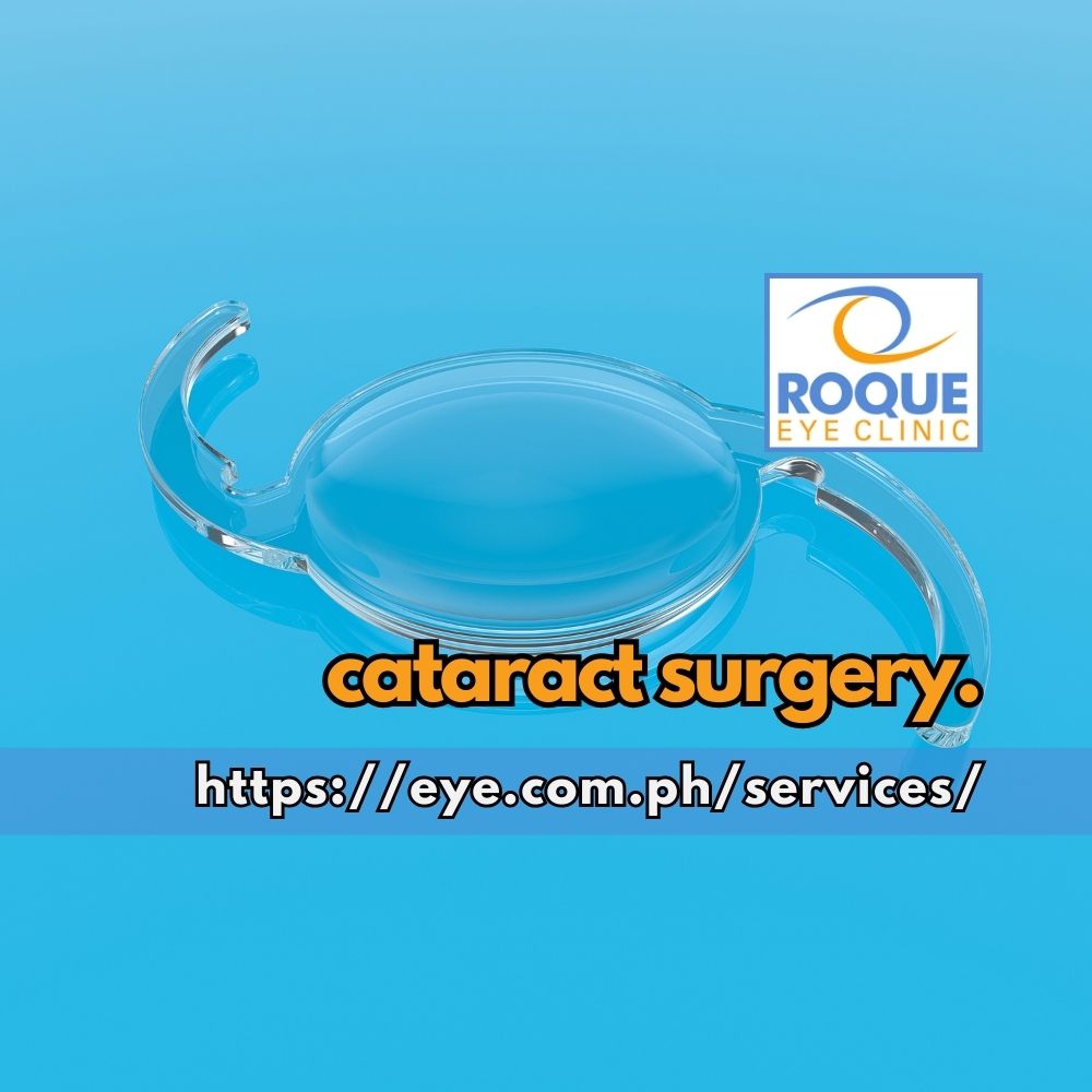 CATARACT SURGERY