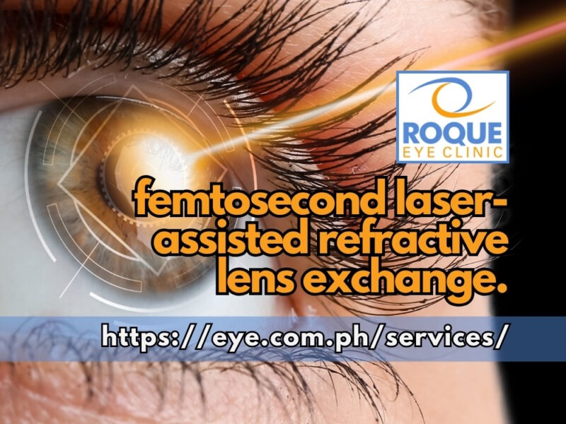FEMTOSECOND LASER-ASSISTED REFRACTIVE LENS EXCHANGE