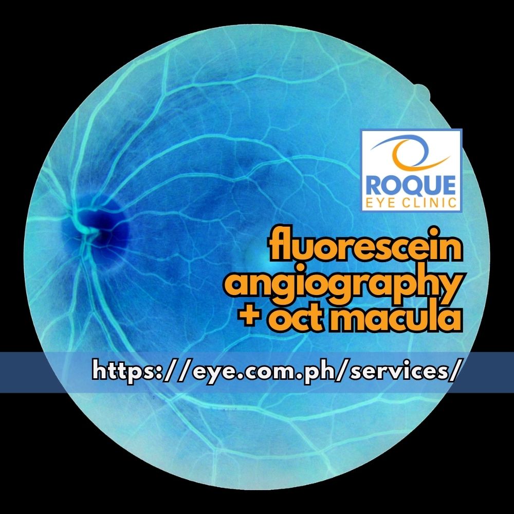 FLUORESCEIN ANGIOGRAPHY + OCT MACULA