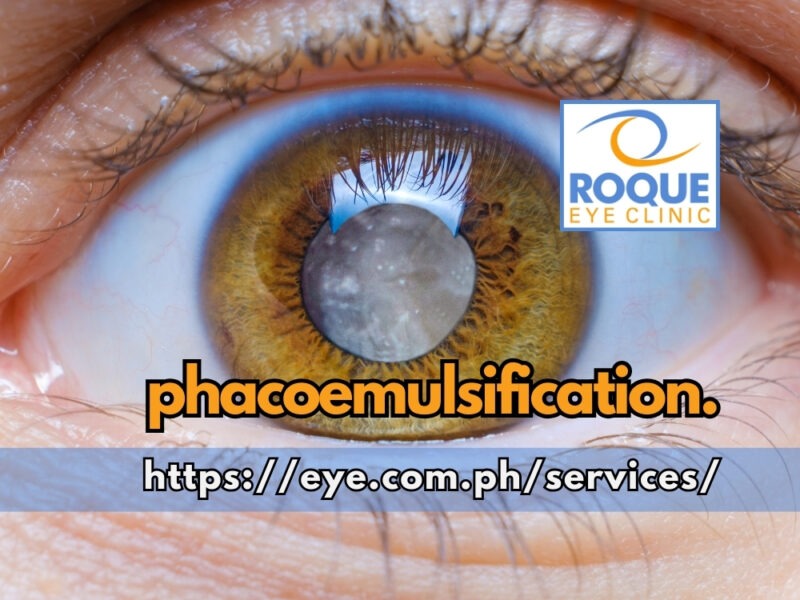 phacoemulsification