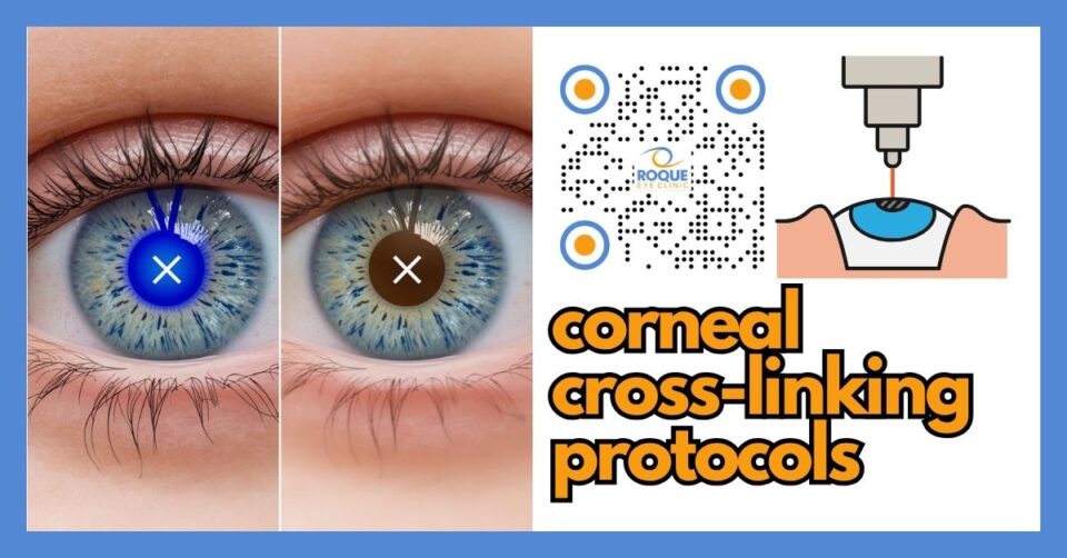 Comparison concept for Dresden and accelerated corneal cross-linking protocols in keratoconus treatment