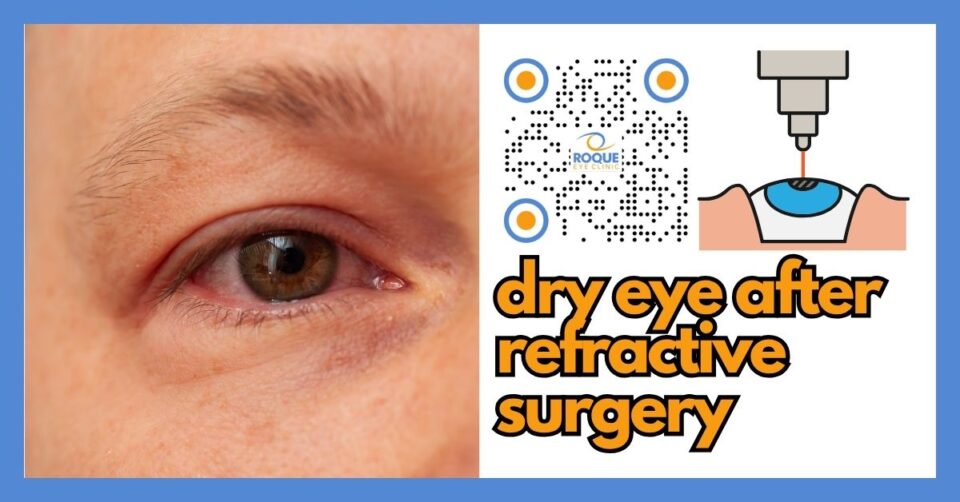 FEATURED IMAGE - Dry Eye After Refractive Surgery Timeline