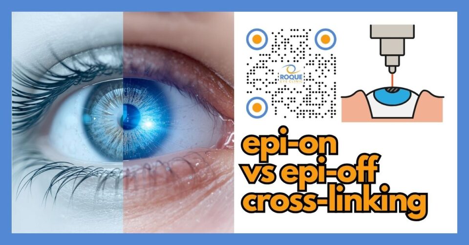 Medical illustration comparing epi-on and epi-off corneal cross-linking techniques
