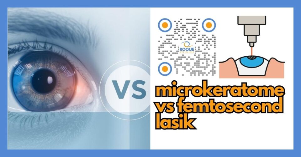 Comparison illustration of microkeratome LASIK and femtosecond LASIK flap creation methods
