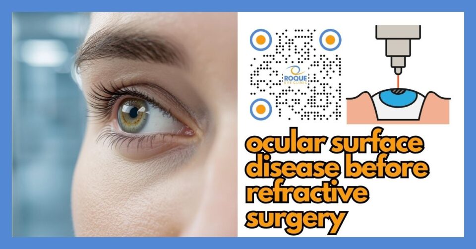 Patient undergoing ocular surface and tear film evaluation before refractive surgery