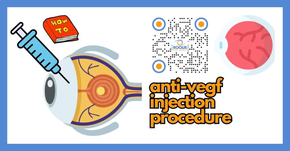 Illustration of an anti-VEGF intravitreal injection procedure for diabetic retinal disease