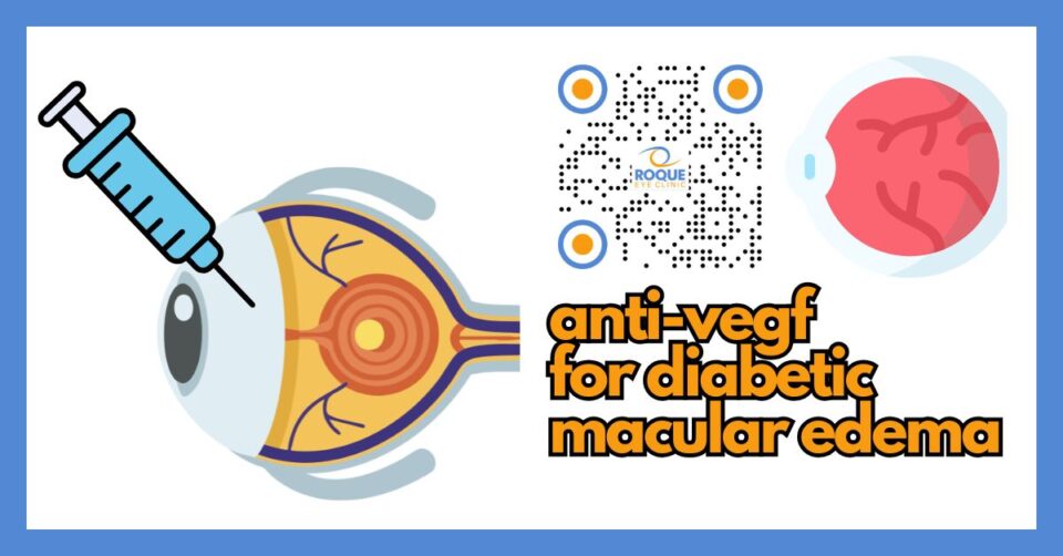 Illustration showing anti-VEGF treatment for diabetic macular edema in the retina
