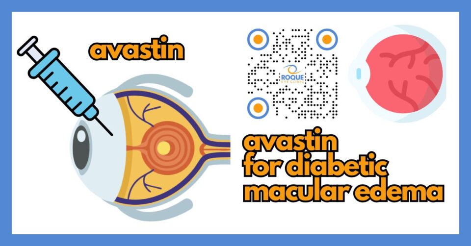 Medical illustration showing Avastin treatment for diabetic macular edema and reduced retinal swelling