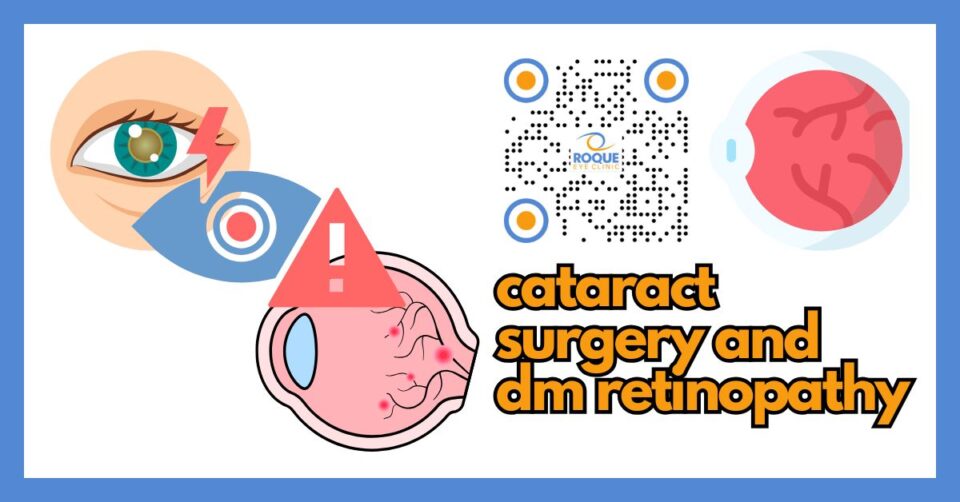 Illustration showing cataract surgery planning in an eye with diabetic retinopathy