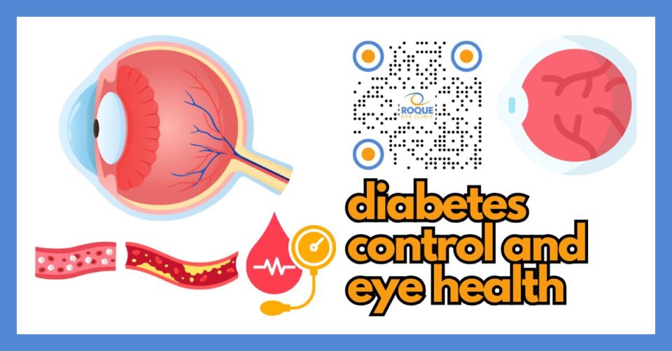 Infographic showing how blood sugar, blood pressure, and cholesterol control help protect retinal eye health in diabetes