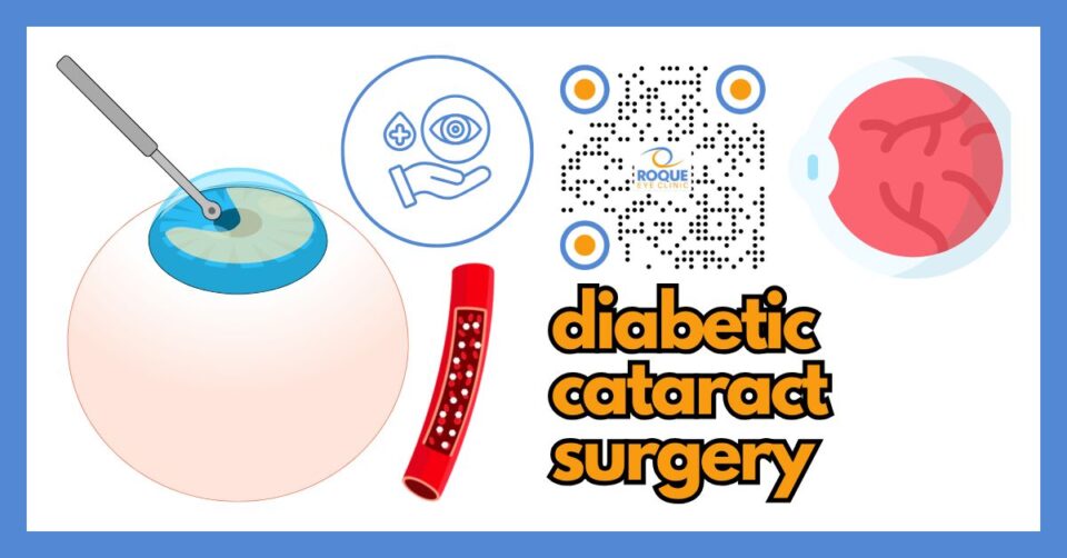 Illustration showing cataract surgery in a patient with diabetes and the need for retinal evaluation