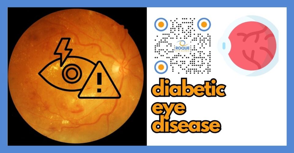 Diabetic eye disease affecting the retina (diabetic retinopathy and diabetic macular edema)