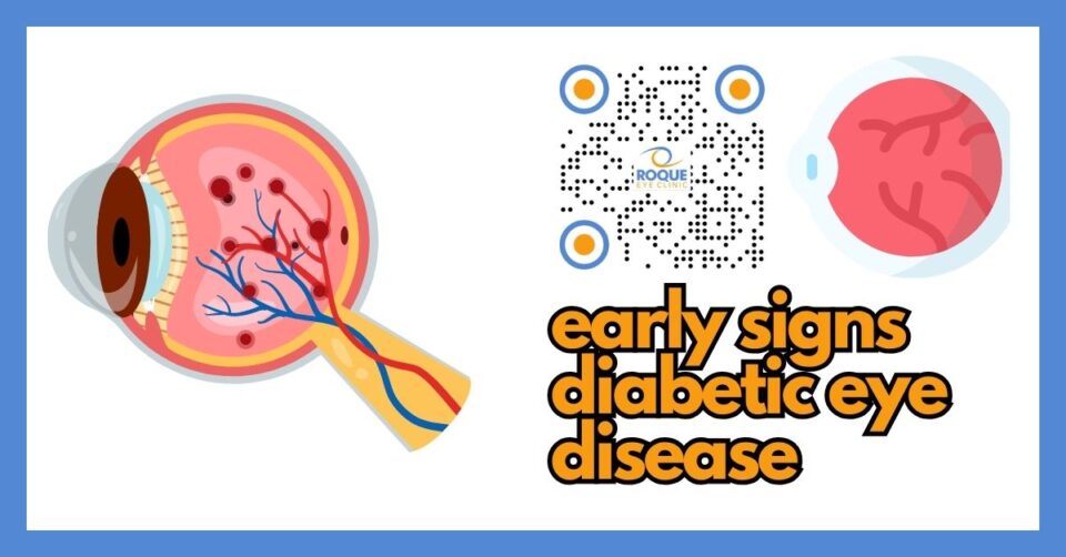 Early signs of diabetic eye disease including blurry vision, wavy lines, and floaters