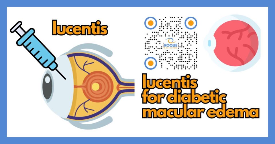 Medical illustration showing Lucentis treatment for diabetic macular edema